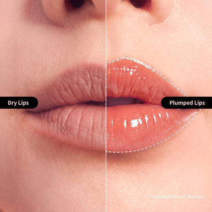 Nida Ultimate Lip Care Set (Lip Serum + Lip Mask)