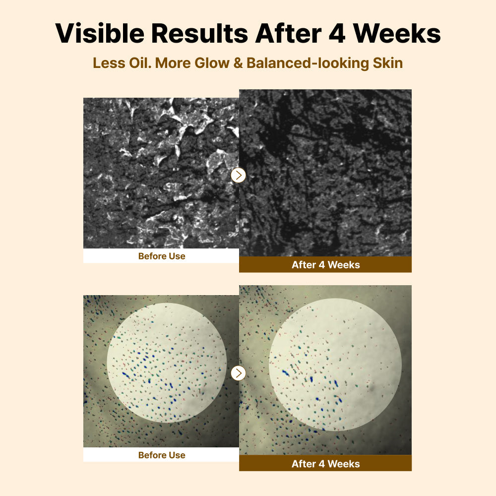 Nida White Rice Whitehead Exfoliating Serum