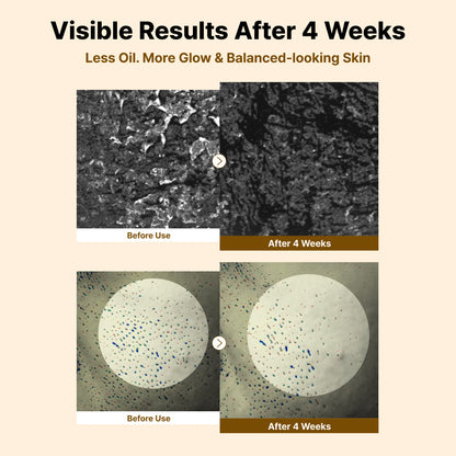 Nida White Rice Whitehead Exfoliating Serum