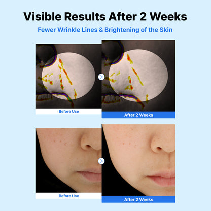 Nida Youthful Glass Skin Bundle